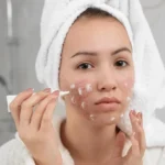teen-red-acne-skin-care-routine-1480